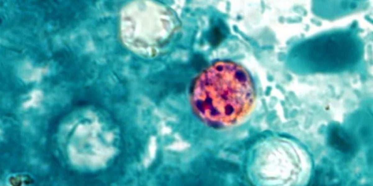 Health Department offers update on cyclosporiasis cases