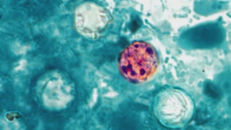 FILE - Cyclosporiasis
